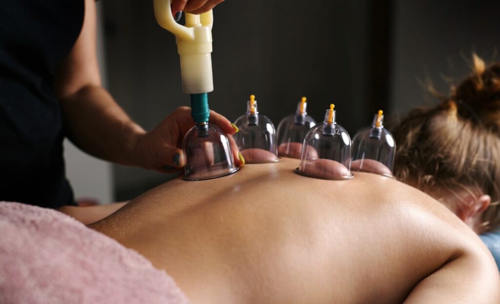 Myofascial Cupping Calgary School